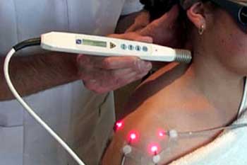 Laserakupunktur und Lasertherapie